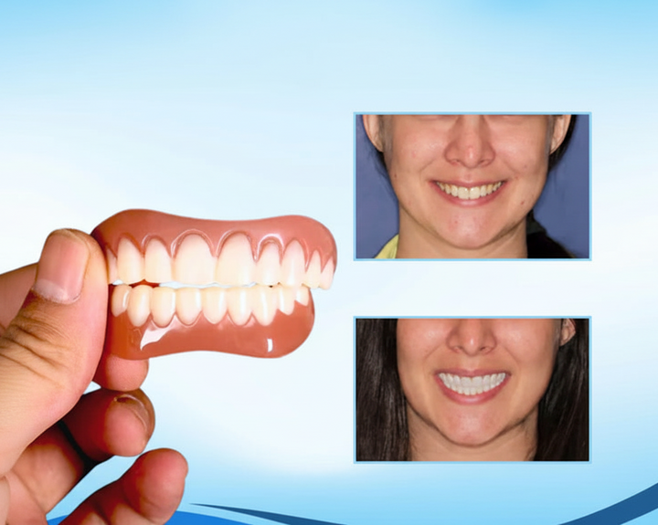 Set de Carillas Dentales Cosméticas de Ajuste a Presión para Dientes Superiores e Inferiores